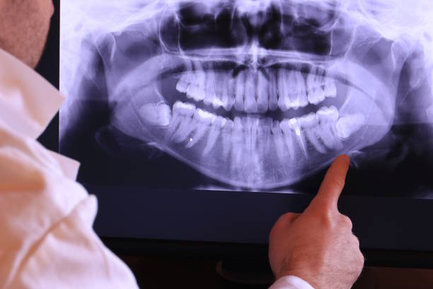 Best Emergency Treatment for Dental Infections or Abscesses in Fort Salonga, NY